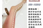 刮痧瘦腿：拥有纤细美腿的秘密