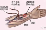 【怎么练出手臂血管明显】如何锻炼手臂血管，轻松练出线条分明的手臂血管