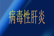 病毒性肝炎的症状及相关信息