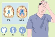 脑积水的原因及其危害分析