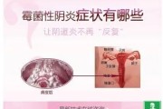 霉菌性阴炎的症状：了解这些不容忽视的身体信号