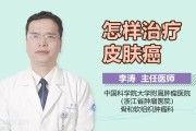 皮肤癌治疗：综合干预策略的关键