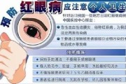 红眼病症状：了解红眼病的症状和处理方法