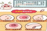 乳癌症状：了解早期征兆，守护女性健康