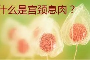 宫颈息肉的症状及其病情分析