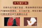 支气管扩张症状：了解病情及预防方法