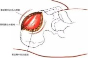 【健身饮食需要注意什么】健身必备：如何正确量取髂骨