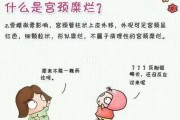 宫颈糜烂的原因及其危害