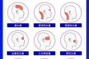 头痛的原因和治疗方法：全面了解头痛的原因及适合的治疗方法