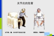 骨关节炎：疼痛经历与治疗方法