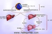 丙肝早期症状揭秘：警惕无症状性感染