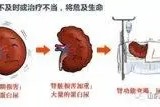 尿毒症网：了解尿毒症症状、预防和治疗的权威平台