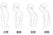 【怎么删除体能训练记录】如何判别肩圆？了解肩圆的特征和判断方法