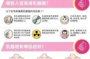 乳腺癌中期症状与预防措施