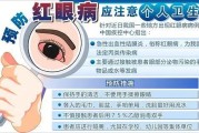 红眼病的治疗方法