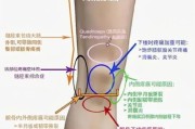 【健身膝盖响是怎么回事】健身中膝盖响是怎么回事？