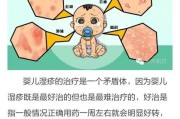 婴儿湿疹治疗方法：寻找最佳的护理方法