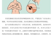 预防乳腺癌的重要措施