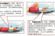 【蚂蚁腰怎么练】伤了膝盖怎么办？教你正确处理和康复