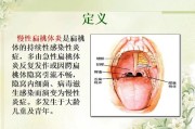 慢性扁桃体炎的症状、治疗与预防