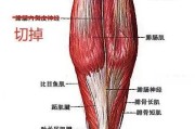 【小腿肌肉酸痛的原因和消除方法】小腿鸡肉怎么消除？