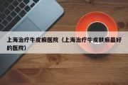 上海治疗牛皮癣医院：提供专业牛皮癣治疗服务