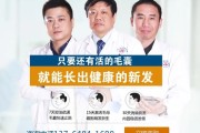 上海哪家医院看脱发好