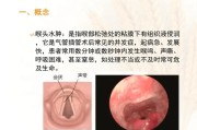 喉头水肿——原因、症状及治疗方法