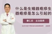 生殖器疱疹症状图-提前了解疾病迹象