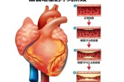 【健身完血管明显怎么办】如何解决健身后血管明显的问题？