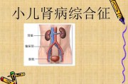 小儿肾病综合征：病因、症状及治疗