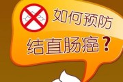 结肠癌：预防与治疗措施详解