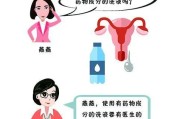 阴道分泌物增多该如何应对？