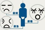 女性尿频尿痛：症状、原因及治疗方法