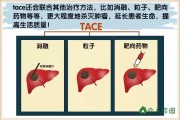 晚期肝癌的治疗：争取时间，寻找希望