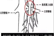 了解胡桃夹综合症：病因、症状和治疗方法