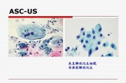 关于鳞状上皮细胞的特点和功能