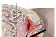 了解阴道后穹窿的重要性及其保健方法