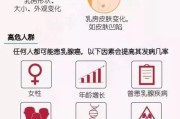 乳腺癌：早期发现，及时治疗，拒绝恶性侵袭